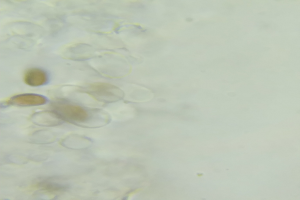 Mikroskopbild von kleinen gelben und weißen Sporozoen-Zellen auf einer weißen Oberfläche.