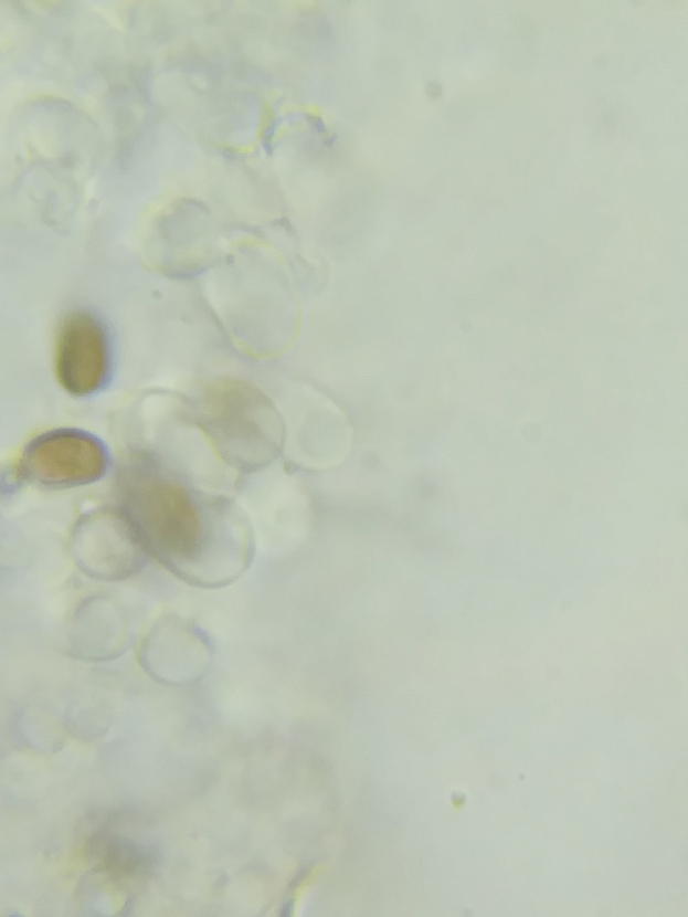 Mikroskopbild von kleinen gelben und weißen Sporozoen-Zellen auf einer weißen Oberfläche.